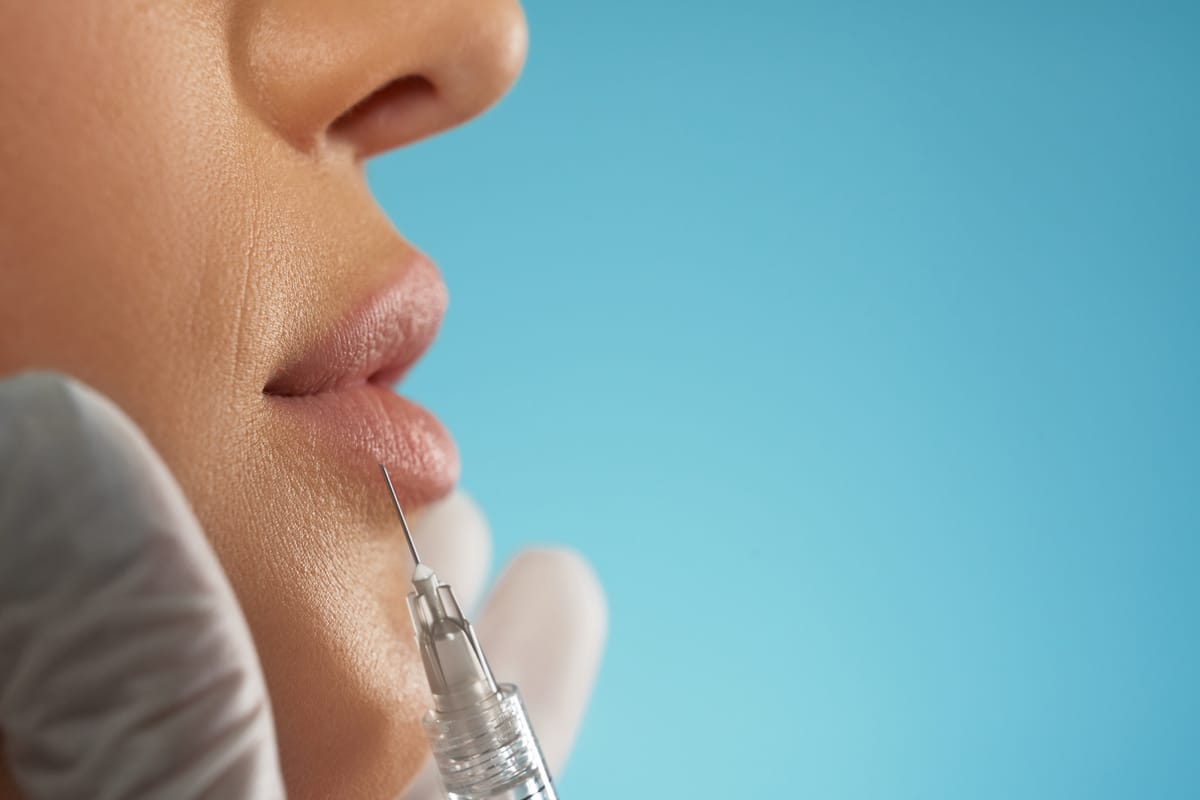 Lip Filler in Miami (2025 Guide)