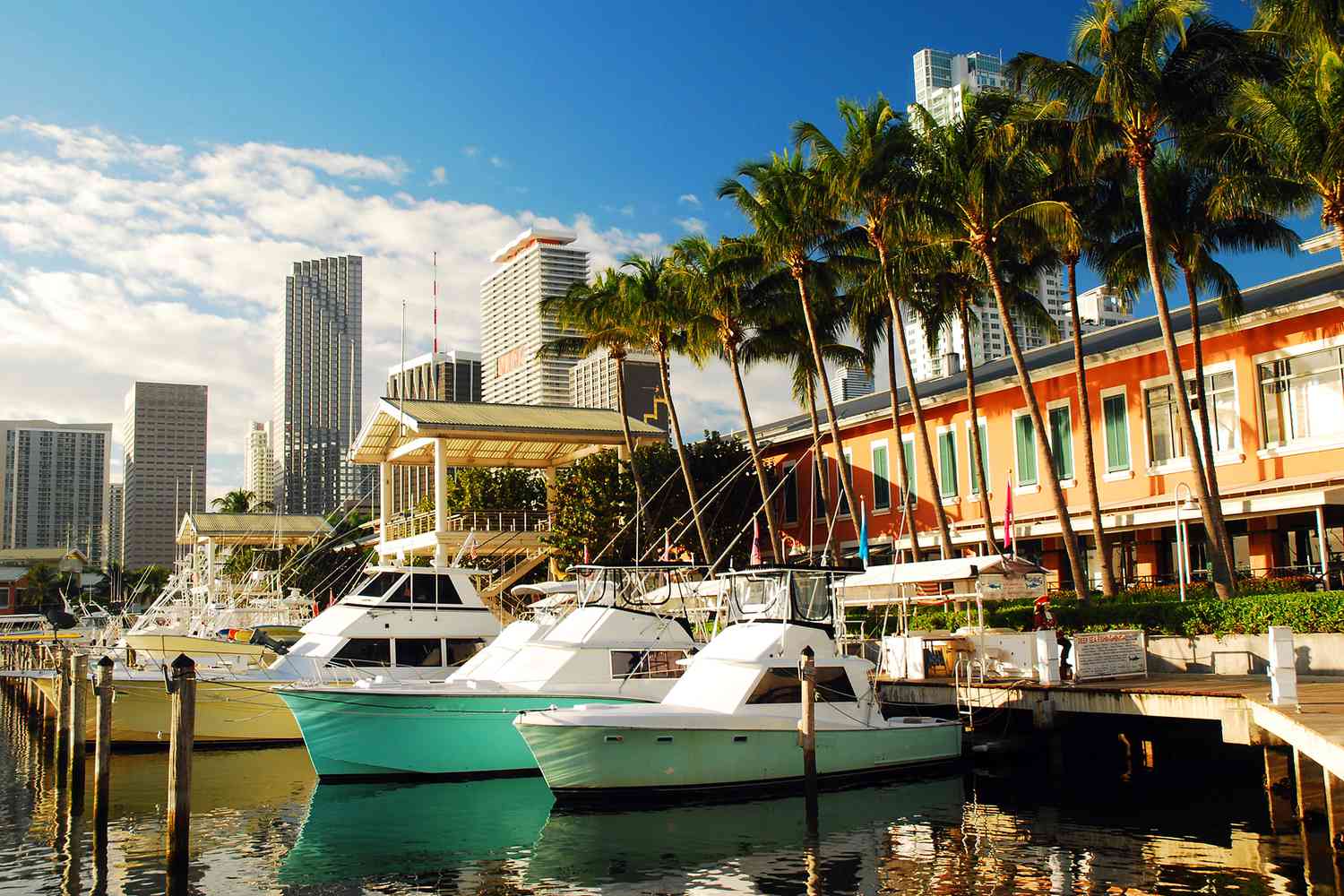 BBL with Liposuction in Miami (2025 Guide)