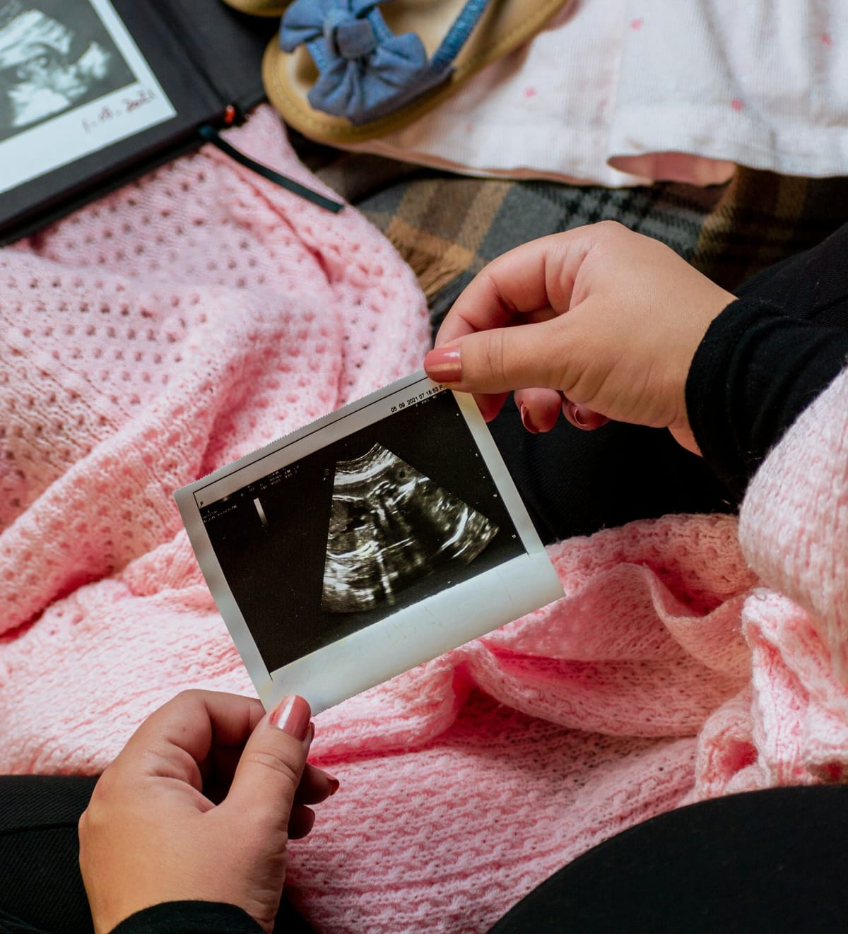 Can I Get a Mommy Makeover Before Having Kids?