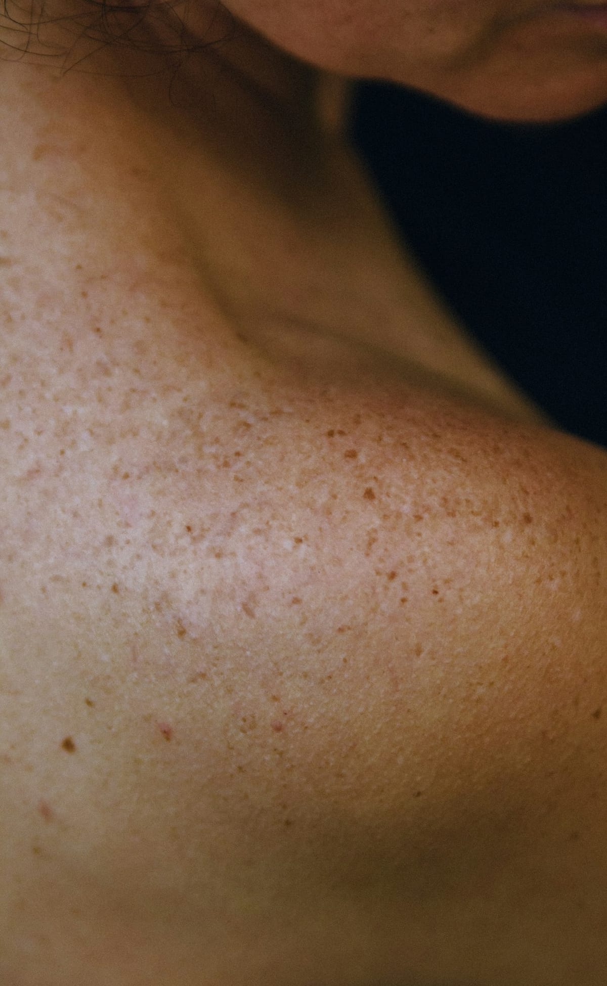 Best Skin Tightening Surgeons in Chicago (2025 Guide)