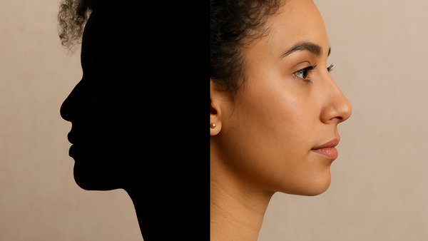 Split-face portrait of woman showing silhouette and refined nose after ethnic rhinoplasty