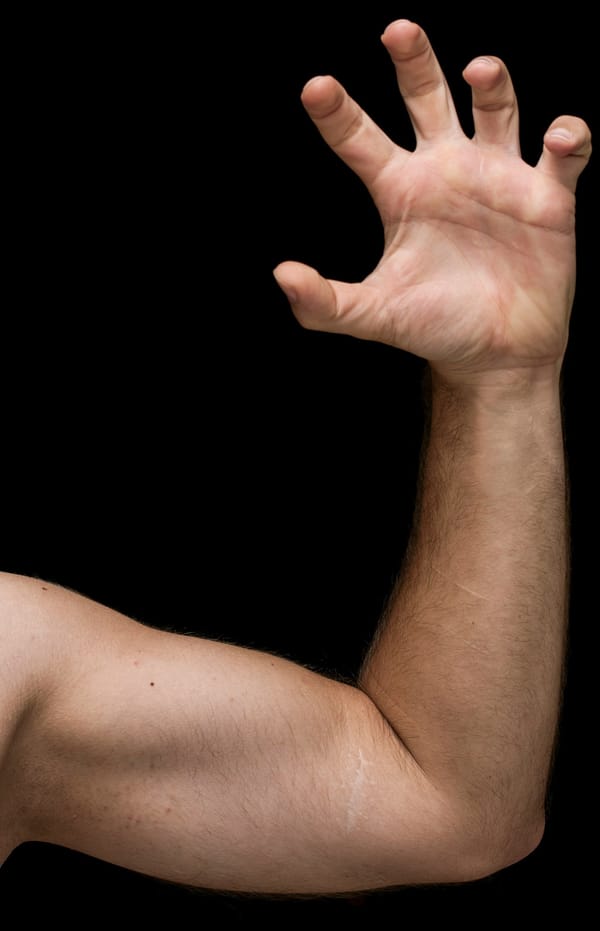 Best Arm Lift Surgeons in Dallas (2025 Guide)