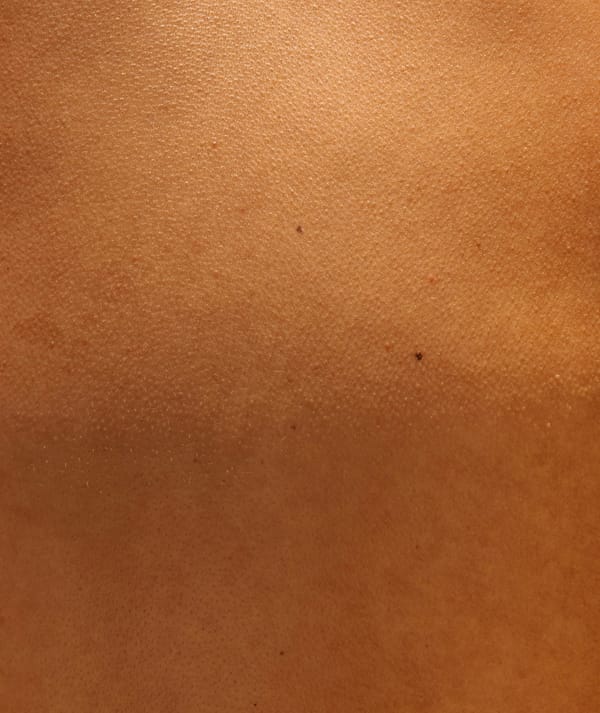 Skin Tightening Cost in Los Angeles (2025 Guide)