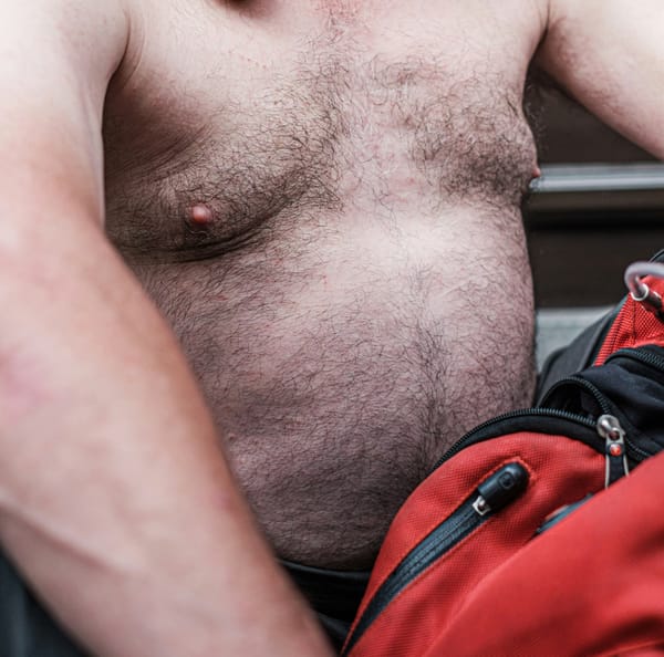 Male Liposuction vs. CoolSculpting — Which Delivers Sharper Definition?