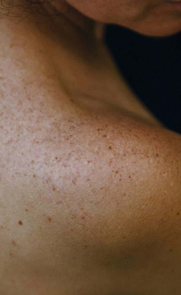 Best Skin Tightening Surgeons in Chicago (2025 Guide)